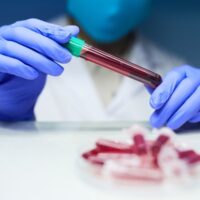 New Blood Test Could Help Detect TBIs in Minutes